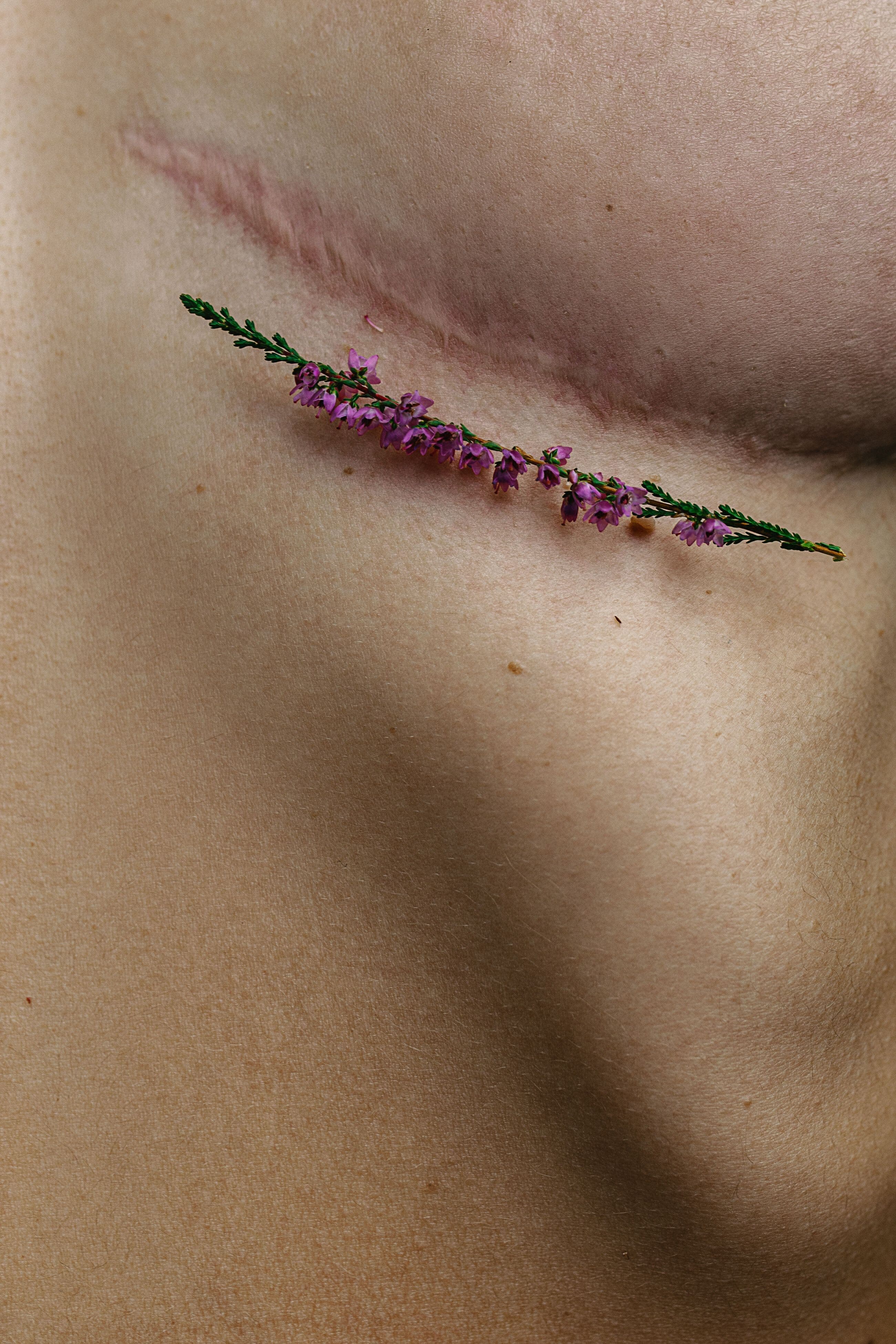 Skin's Memory
