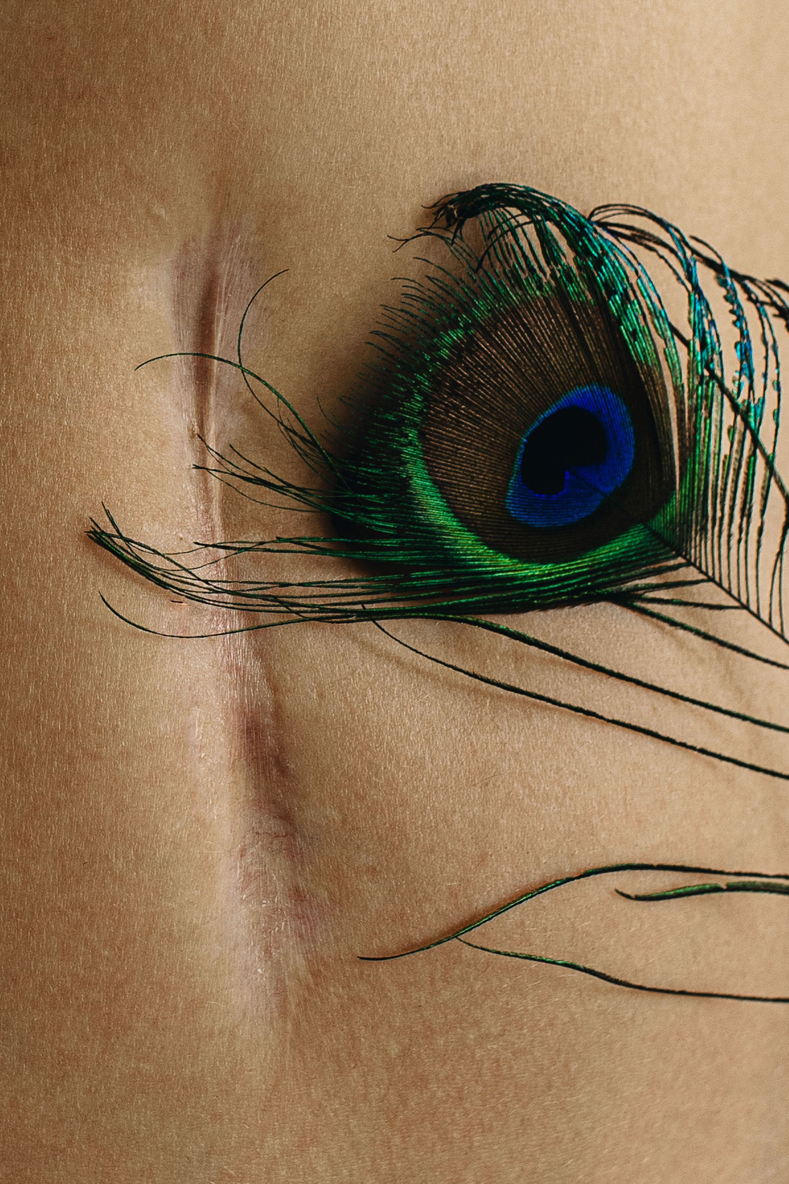 Beauty Grows from Pain